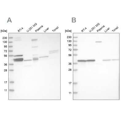 Western Blot: MRPL38 Antibody [NBP1-81673]