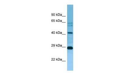 Western Blot: MRPL38 Antibody [NBP2-87825]