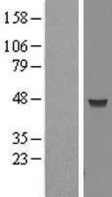 Western Blot: MRPL38 Overexpression Lysate [NBL1-13263]