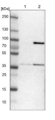 Western Blot: MRPL39 Antibody [NBP1-86815]