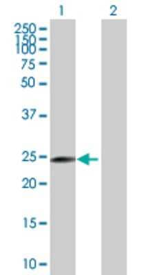 Western Blot: MRPL40 Antibody [H00064976-B01P]