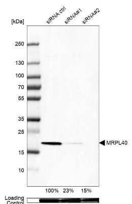 Western Blot: MRPL40 Antibody [NBP1-82620]