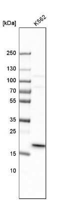 Western Blot: MRPL40 Antibody [NBP1-82620]