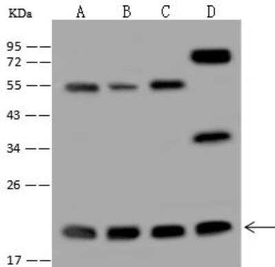 Western Blot: MRPL40 Antibody [NBP3-12583]