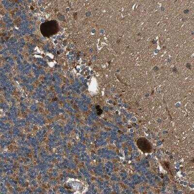 Immunohistochemistry: MRPL27 Antibody [NBP1-87553]