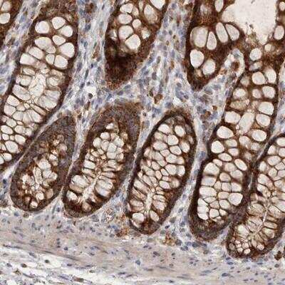 Immunohistochemistry: MRPL41 Antibody [NBP1-88571]