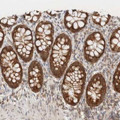 Immunohistochemistry-Paraffin: MRPL41 Antibody [NBP1-88570]