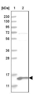 Western Blot: MRPL41 Antibody [NBP1-88570]