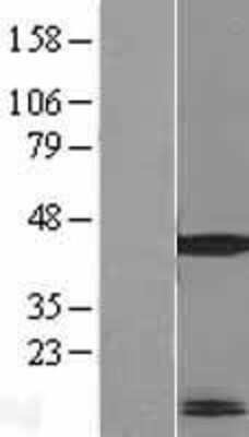 Western Blot: MRPL41 Overexpression Lysate [NBL1-13268]