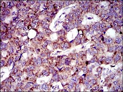 Immunohistochemistry: MRPL42 Antibody (3H6H2) - BSA Free [NBP2-37385]