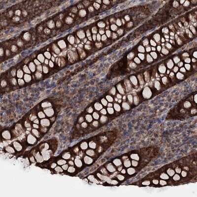 Immunohistochemistry-Paraffin: MRPL42 Antibody [NBP1-83171]