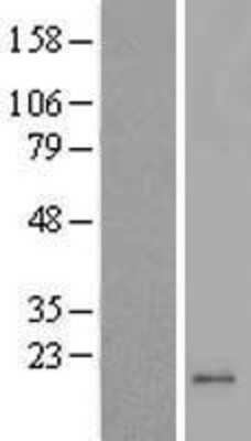 Western Blot: MRPL42 Overexpression Lysate [NBL1-13269]