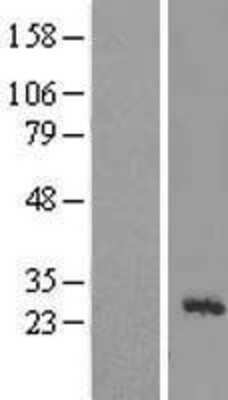 Western Blot: MRPL43 Overexpression Lysate [NBL1-13270]