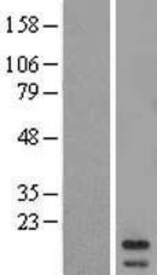 Western Blot: MRPL43 Overexpression Lysate [NBL1-13271]