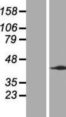 Western Blot: MRPL43 Overexpression Lysate [NBP2-05021]