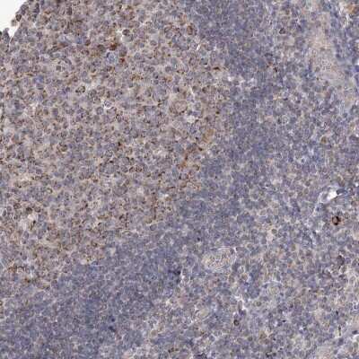Immunohistochemistry: MRPL44 Antibody [NBP2-38394]