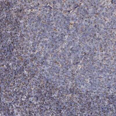 Immunohistochemistry-Paraffin: MRPL44 Antibody [NBP1-82284]