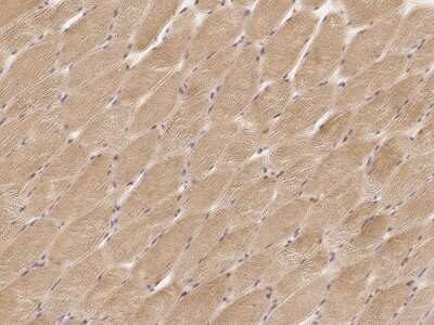 Immunohistochemistry-Paraffin: MRPL44 Antibody [NBP2-96998]