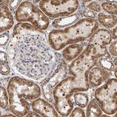 Immunohistochemistry-Paraffin: MRPL45 Antibody [NBP1-82763]