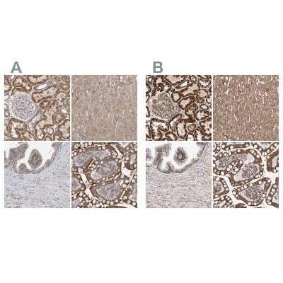 Immunohistochemistry-Paraffin: MRPL45 Antibody [NBP1-82763]