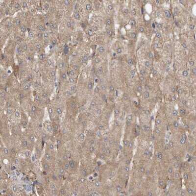 Immunohistochemistry-Paraffin: MRPL45 Antibody [NBP1-82763]