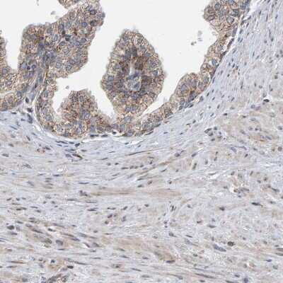 Immunohistochemistry-Paraffin: MRPL45 Antibody [NBP1-82763]