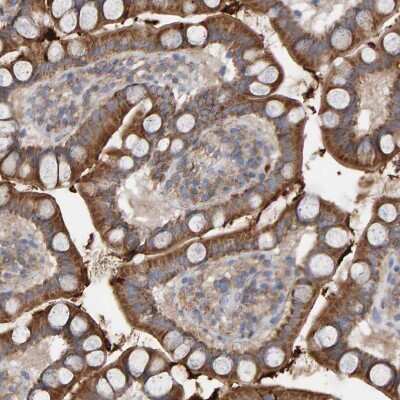 Immunohistochemistry-Paraffin: MRPL45 Antibody [NBP1-82763]