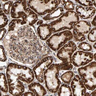 Immunohistochemistry-Paraffin: MRPL45 Antibody [NBP1-82764]