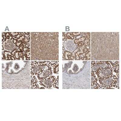 Immunohistochemistry-Paraffin: MRPL45 Antibody [NBP1-82764]