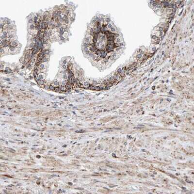 Immunohistochemistry-Paraffin: MRPL45 Antibody [NBP1-82764]