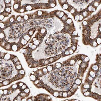 Immunohistochemistry-Paraffin: MRPL45 Antibody [NBP1-82764]