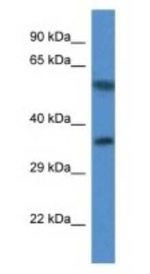 Western Blot: MRPL45 Antibody [NBP1-74261]