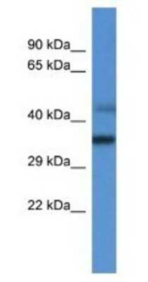 Western Blot: MRPL45 Antibody [NBP1-74262]