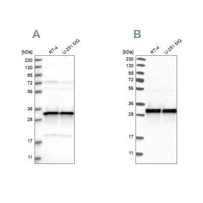 Western Blot: MRPL45 Antibody [NBP1-82763]