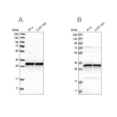 Western Blot: MRPL45 Antibody [NBP1-82764]