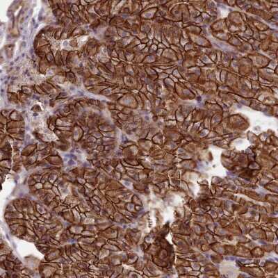 Immunohistochemistry: MRPL46 Antibody [NBP2-47369]