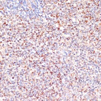 Immunohistochemistry-Paraffin: MRPL46 Antibody - Azide and BSA Free [NBP2-94771]