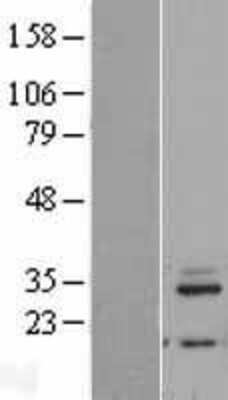 Western Blot: MRPL46 Overexpression Lysate [NBL1-13273]