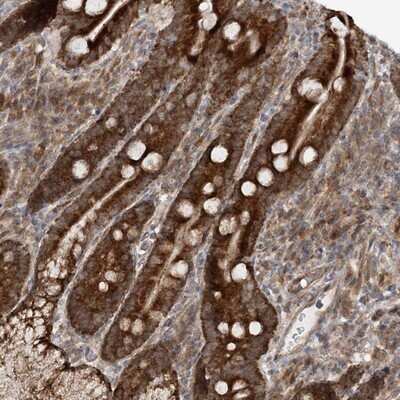 Immunohistochemistry-Paraffin: MRPL47 Antibody [NBP1-85663]