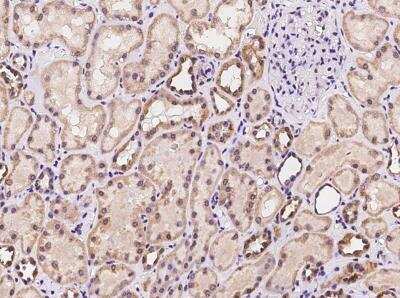 Immunohistochemistry-Paraffin: MRPL47 Antibody [NBP3-06454]