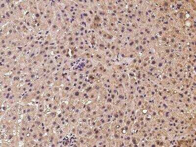 Immunohistochemistry-Paraffin: MRPL47 Antibody [NBP3-06454]