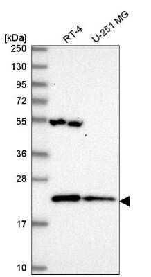 Western Blot: MRPL47 Antibody [NBP2-55844]