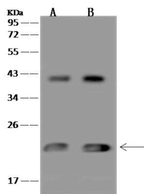 Western Blot: MRPL47 Antibody [NBP3-06454]