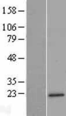 Western Blot: MRPL47 Overexpression Lysate [NBL1-13274]