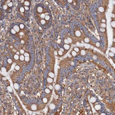 Immunohistochemistry-Paraffin: MRPL48 Antibody [NBP2-30586]