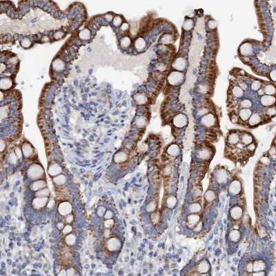 Immunohistochemistry-Paraffin: MRPL48 Antibody [NBP2-30963]