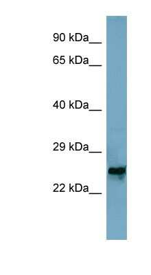 Western Blot: MRPL48 Antibody [NBP1-54676]