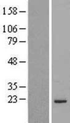 Western Blot: MRPL48 Overexpression Lysate [NBL1-13275]