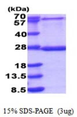 SDS-PAGE: Recombinant Human MRPL48 His Protein [NBP2-51850]