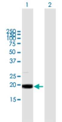 Western Blot: MRPL49 Antibody [H00000740-B01P]